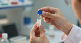 Tiny silica particles wiped out aggressive prostate cancer in mice